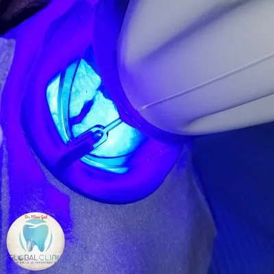 دكتور مينا جاد اخصائى طب و جراحة الفم و زراعة الاسنان