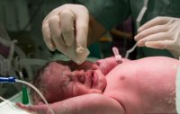 مخاطر التفاف الحبل السري حول رقبة الجنين وطرق الوقاية 