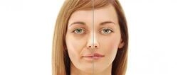 التهاب العصب السابع أسبابه أعراضه وعلاجه ببساطة