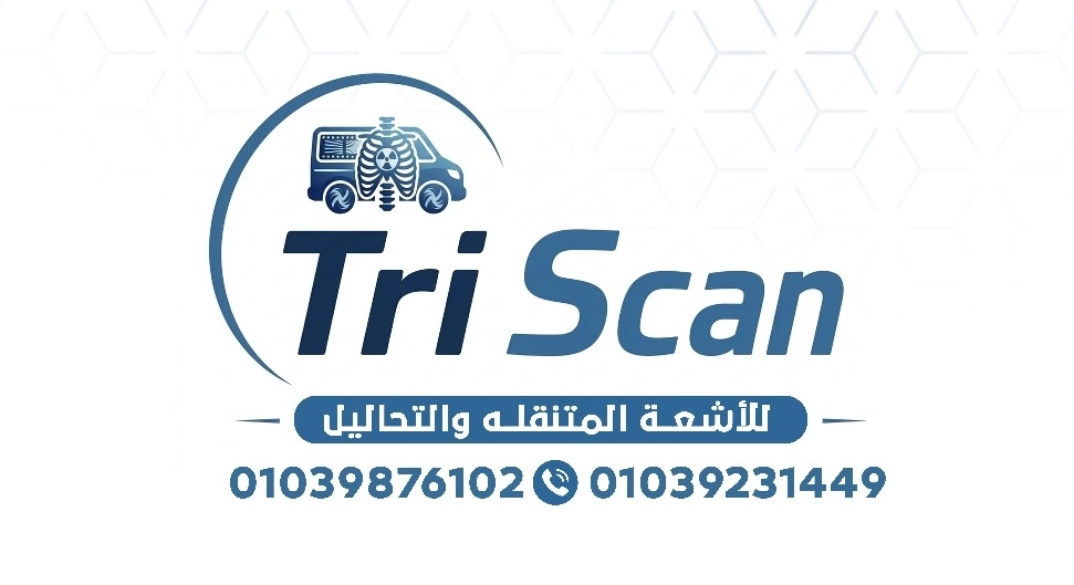 تراي سكان للأشعة المتنقلة والتحاليل