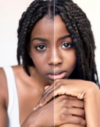 Serious causes of skin turning black