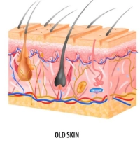 MORPHEUS8 technology and the skin problems it can treat