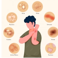 What are the symptoms of skin cancer, all its stages, and the fastest treatment methods