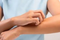 أسباب حكة الجسم المفاجئه عند المرأة وطريقة علاجها