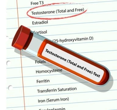 ما هو تحليل Free Testosterone ودلالات نتائجه