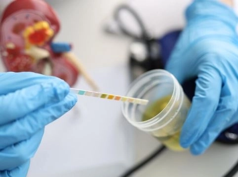 تحليل فيروس الكبد B HBsAg وHBV DNA وأهم دلالاته