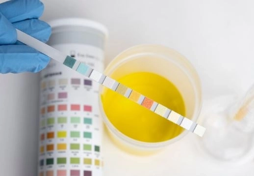 تحليل Hb Electrophoresis لفهم أمراض الدم الوراثية بدقة