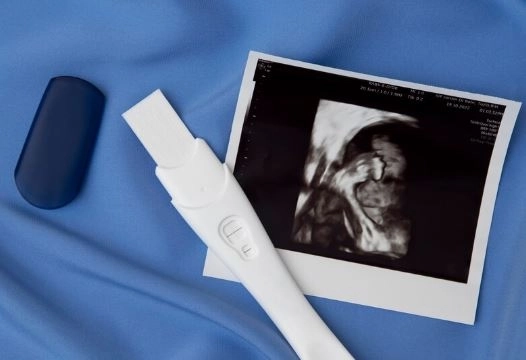 فحص NIPT للحامل يكشف جنس وتشوهات الجنين
