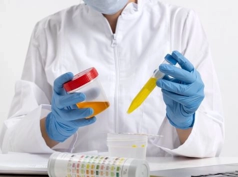  تحليل Anti-TTG IgA/IgG الفحص الذهبي لتشخيص مرض السيلياك بدقة