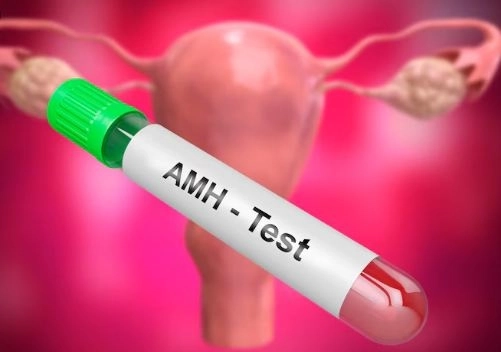 تحليل تكيس المبايض أهم الفحوصات لتشخيص PCOS