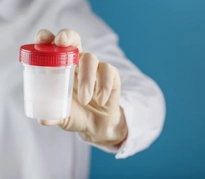 تحليل السائل المنوي متى تحتاجه؟ وكيف تقرأ نتائجه بدقة