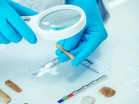 ما هو تحليل Anti-Ribosomal P؟ ولماذا يُستخدم في تشخيص الذئبة العصبية