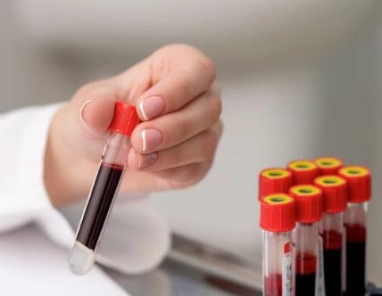 Basic blood tests the most important tests and when you need them