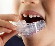 واقي الأسنان الليلي للأطفال كيفية الاختيار و أسباب الارتداء وأفضل طرق التنظيف