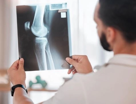 أشعة المفاصل والركبة والكتف أنواعها ودواعي إجرائها