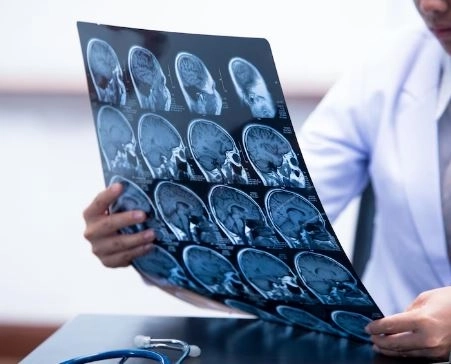 When and why should brain and nerve imaging be performed with MRI and CT