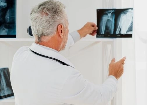 أشعة DEXA لقياس كثافة العظام الفوائد التحضيرات النتائج    