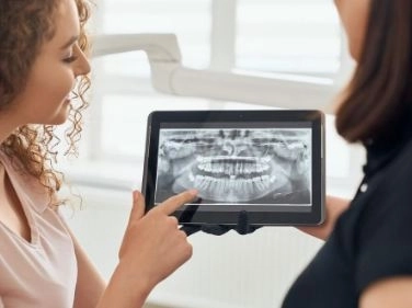 أشعة الفحص الثنائي Bitewing X-ray فوائدها واستخداماتها