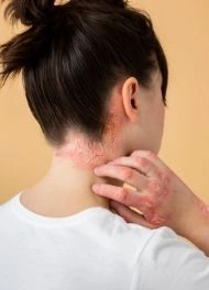 Mixed connective tissue disease causes symptoms and effective treatment methods