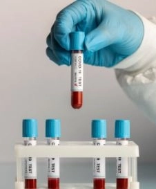 VLDL analysis findings and associated health risks VLDL analysis findings and associated health risks