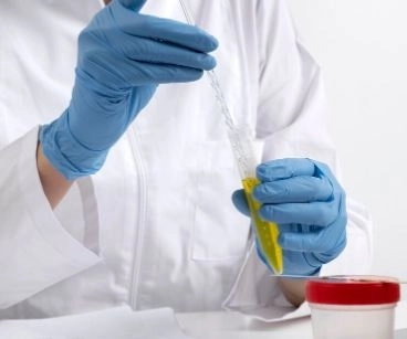 تحليل مستوى الباراسيتامول خطوات الفحص وتحليل النتائج