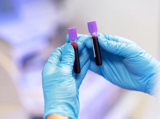 فحص مستوى الفانكومايسين في الدم ما هو؟ ولماذا مهم لعلاج العدوى