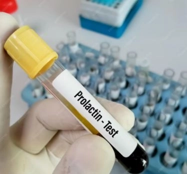 تحليل بروتين المكمل C3 الفوائد النتائج والمعدل الطبيعي تحليل بروتين المكمل C3 الفوائد النتائج والمعدل الطبيعي