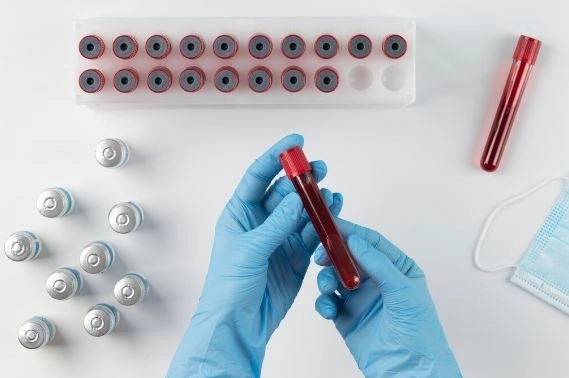 تحليل الكيتون في الدم التحضير والمخاطر ونتائج الفحص تحليل الكيتون في الدم التحضير والمخاطر ونتائج الفحص