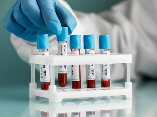 تحليل الفسفور في الدم ما هو كيف يتم إجراؤه ولماذا هو مهم تحليل الفسفور في الدم ما هو كيف يتم إجراؤه ولماذا هو مهم