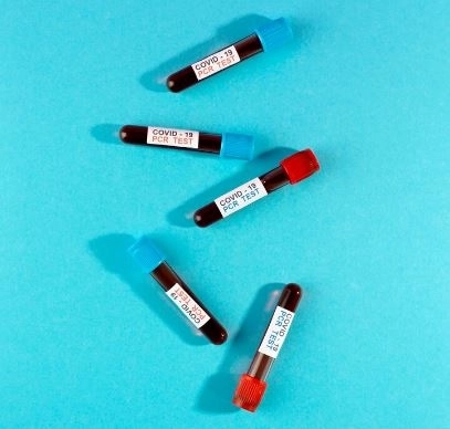 Blood chloride analysis Meaning of results and risks of the test Blood chloride analysis Meaning of results and risks of the test