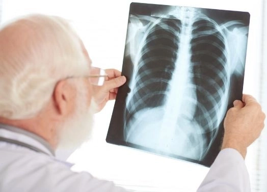شلل العصب الصدري الطويل بين الأسباب والعلاج تأثيره على الرقبة وعلاقته بالوزن الزائد