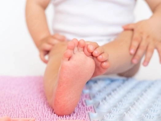 القدم الحنفاء (القدم المخلبية) الأنواع والأعراض والأسباب وطرق العلاج الحديثة 