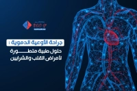 الاسباب الرئيسية لاجراء جراحة الاوعية الدموية​
