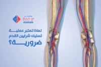 اسباب اجراء عملية تسليك شرايين القدم​