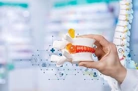  دور العلاج الطبيعي في علاج الانزلاق الغضروفي بدون جراحة
