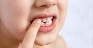  العادات الخاطئة وتأثيرها على أسنان الأطفال  مع د سارة عبد النبي