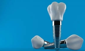 زراعة الأسنان بدون ألم: كيف نجعلها سهلة في ToothMate؟