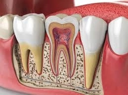 علاج الجذور المتقدم كيف نحافظ على أسنانك الطبيعية في مركز ToothMate؟