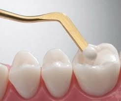 متى تحتاج الحشوات التجميلية؟ نصائح من د. شريف سمير