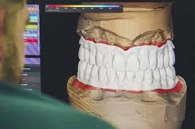 تركيبات الأسنان CAD/CAM ولماذا يثق بها د. أحمد حسيني