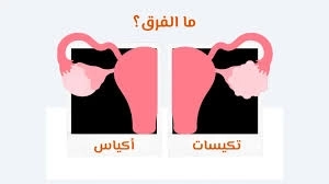 الفرق بين تكيس المبايض والالتصاقات مع د. سحر المرشدي