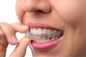 كيف تحافظ على أسنانك بعد التقويم؟ أهم النصائح من أطباء Dental Land