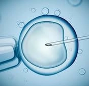 خطوات الحقن المجهري من الألف إلى الياء مع دكتور كريم كمال