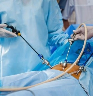 علاج أمراض الذكورة والعقم ودوالي الخصية باستخدام المنظار 