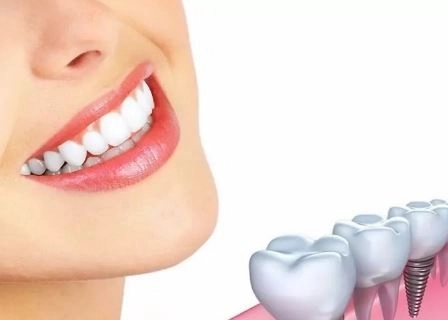 تجميل وزراعة الأسنان: ابتسامتك تبدأ من هنا