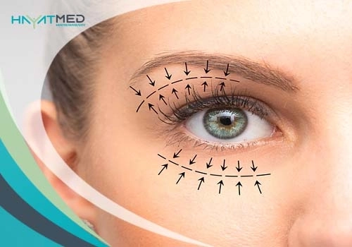 دكتور أحمد جمال هندي – تجميل الجفون والجهاز الدمعي