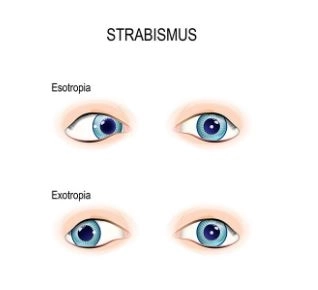 جراحات تجميل الجفون وجراحات الحول: مع دكتور محمود راشد 