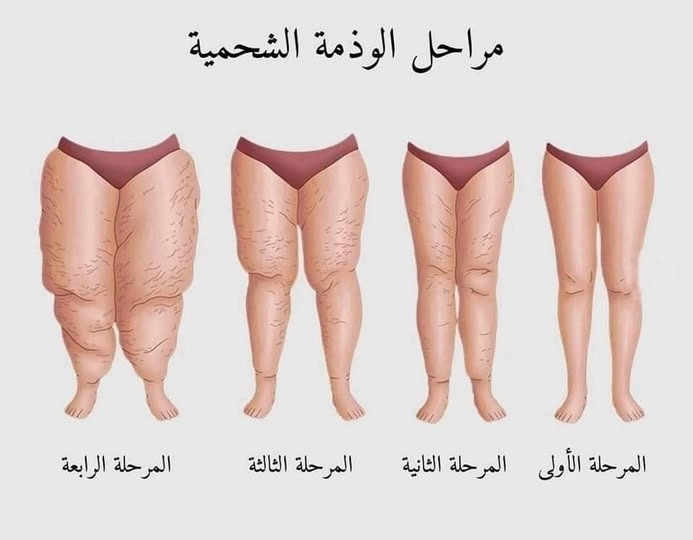 ما هي كما يوضح د أحمد مجدي بكر
