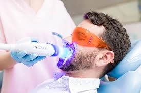تبييض الأسنان بالليزر مع دكتور شريف عشماوي: ابتسامة أكثر إشراقًا 