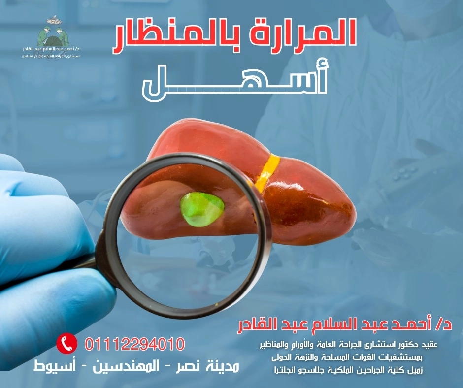  المرارة بالمنظار مع دكتور احمد عبد السلام 